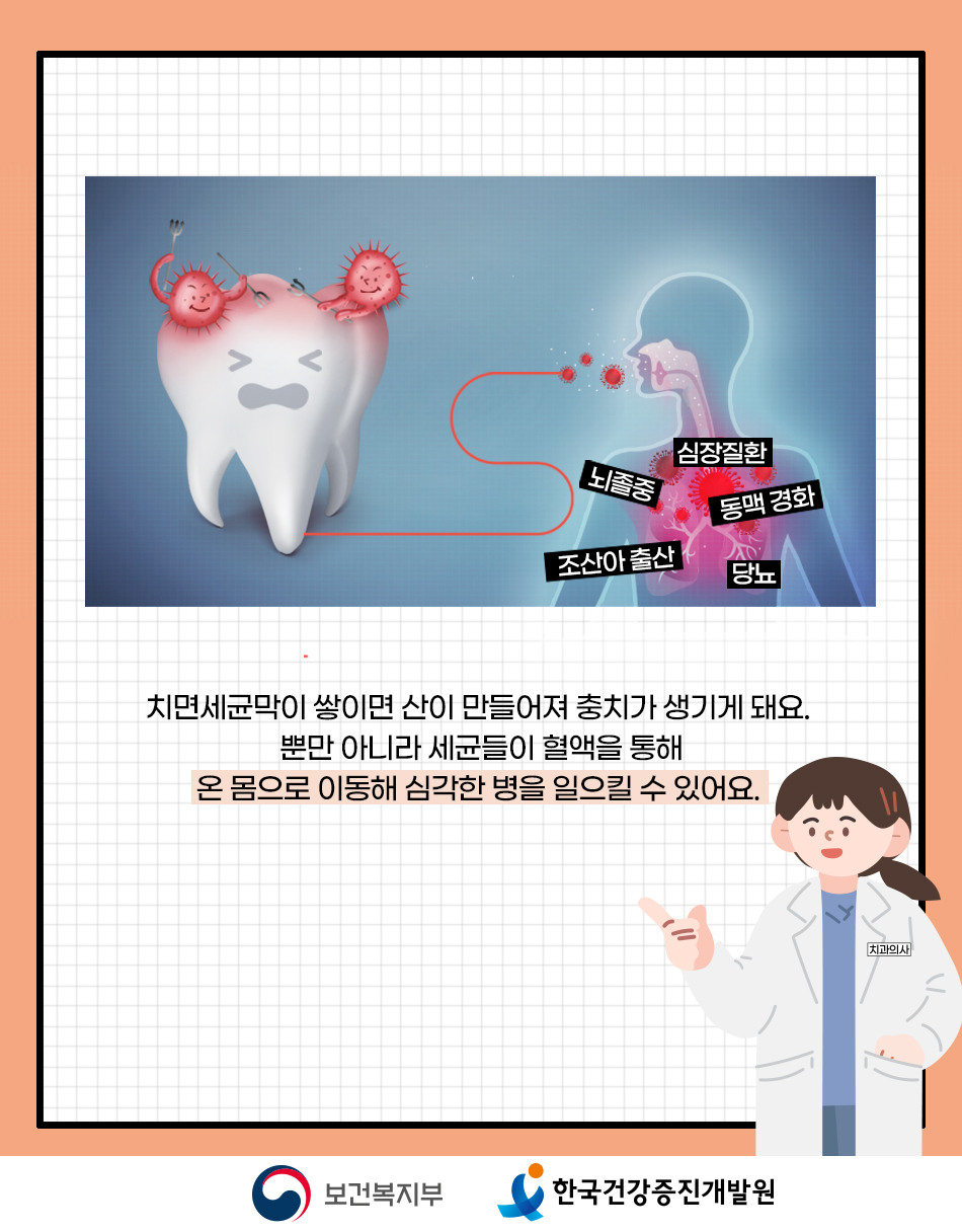 치면세균막이 쌓여 산이 만들어지면 충치가 생기고, 이 세균은 혈액을 통해 온 몸을 돌아다니기도 합니다.